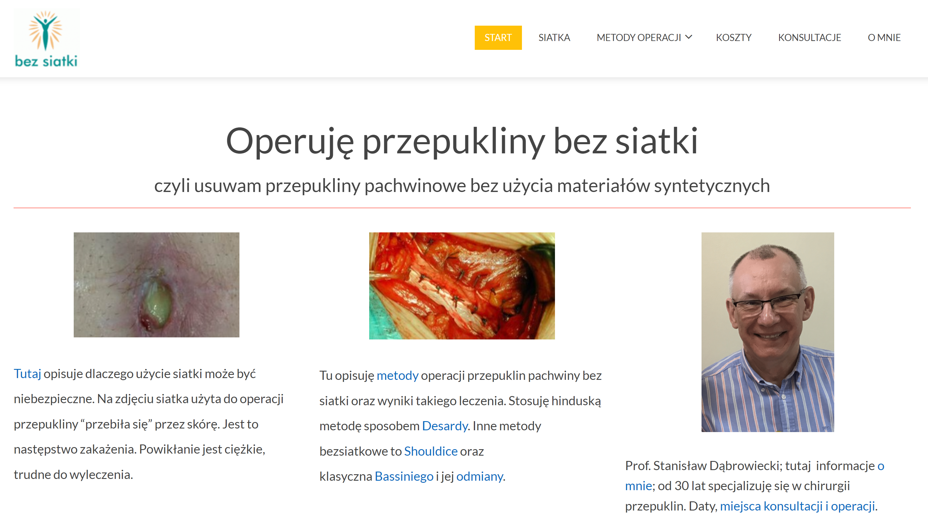 operacje przepuklin bez siatki