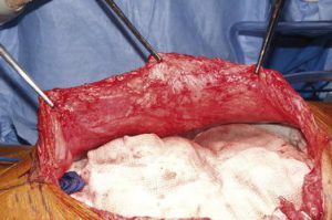 otwary brzuch otwary brzuch