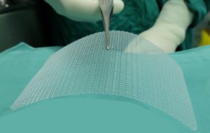 siatka do wszczepienia siatka do wszczepienia