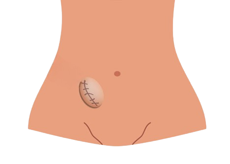 hv schemat hv schemat